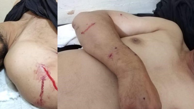 إصابة شخصين ببندقية صيد بمنطقة “أيت بكو” بجماعة أسرير